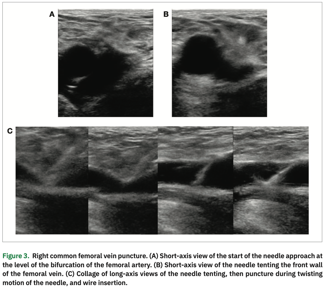 Integrating LongAxis and ShortAxis Views with a Twist for Ultrasound